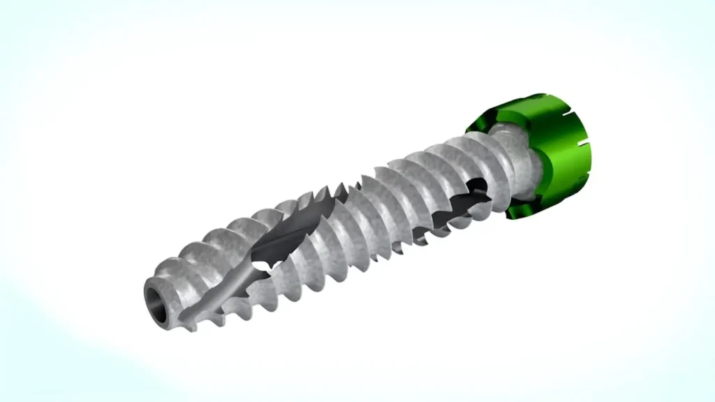 TriMech Tests Alevio Spine’s Implants Through SOLIDWORKS Simulation 9 Alevio Spine Device