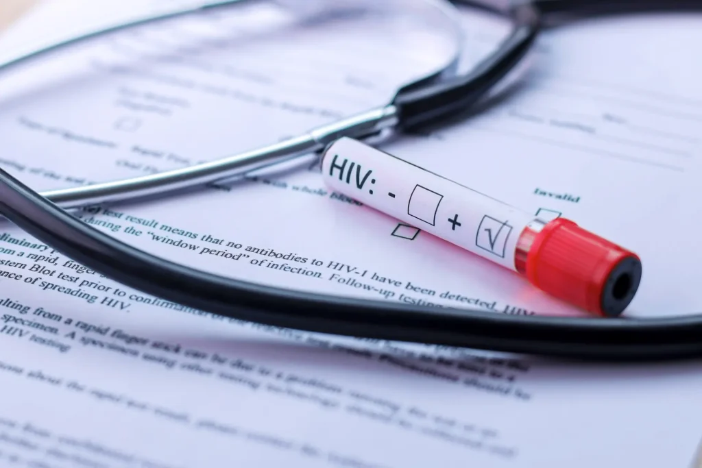A Prototype Production for a Portable Analyzer for HIV Testing 1 HIV patients prototype production